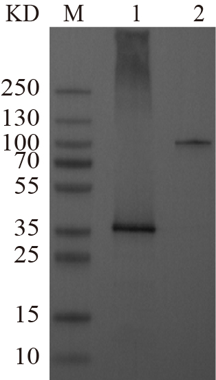 Recombinant TXNIP protein (His tag) Western Blot